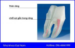 chốt số là gì
