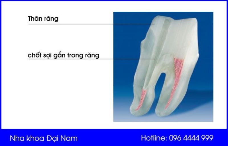 chốt số là gì - Hình 1