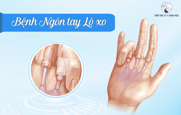 gấp lô là gì - Hình 1