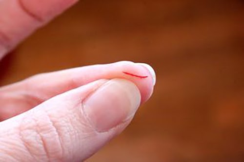 mơ thấy chảy máu đánh con gì - Hình 4