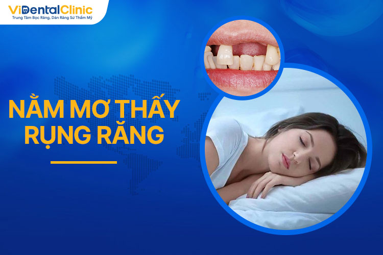 mơ thấy rụng răng đánh con gì - Hình 2